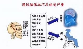 脑供血不足怎么调理